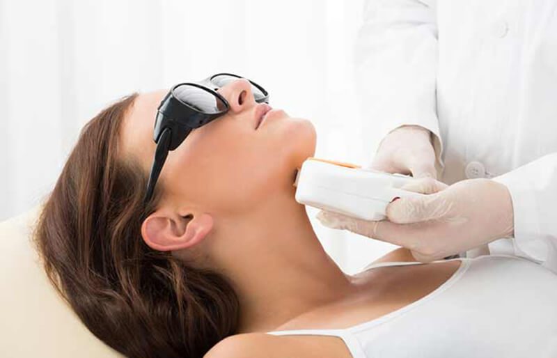 Tổng quan chi tiết về các loại phương pháp điều trị bằng laser được sử dụng để loại bỏ sẹo mụn.