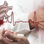 Bệnh tim và những điều bạn cần biết về căn bệnh này