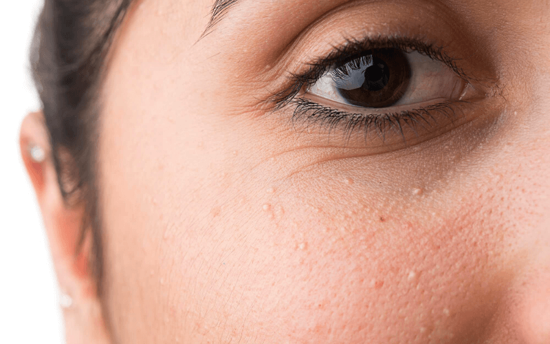 Kết hợp sử dụng kem dưỡng mắt để vùng quanh mắt không bị khô.