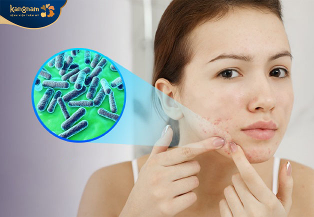 Vệ sinh da không sạch khiến vi khuẩn phát triển mạnh dẫn đến mụn cám hình thành 