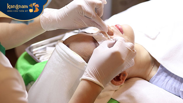 Phương pháp nặn mụn chuẩn y khoa sẽ không để lại thâm, sẹo trên da 