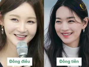 Lúm đồng điếu và lúm đồng tiền khác nhau như thế nào