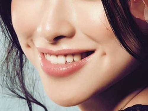 Má lúm đồng điếu là gì